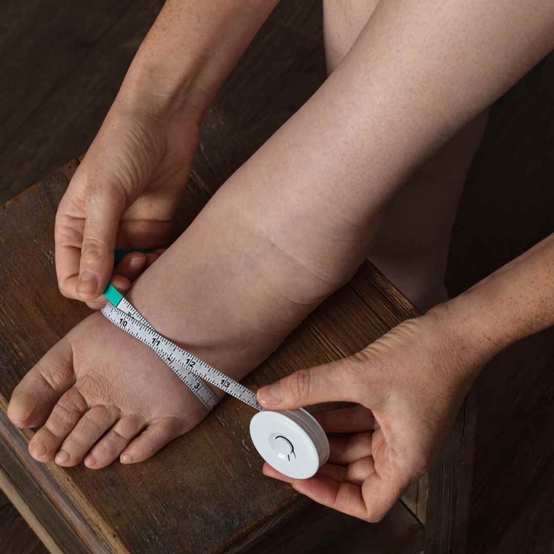 inchaço em pessoas idosas