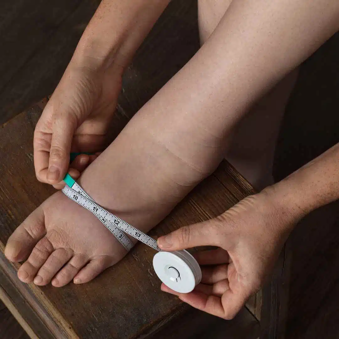 inchaço em pessoas idosas