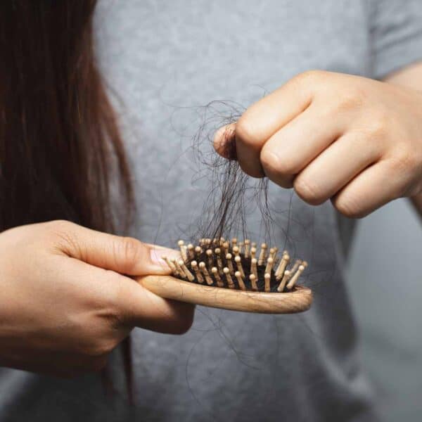 Queda de cabelo sintoma 40 mais