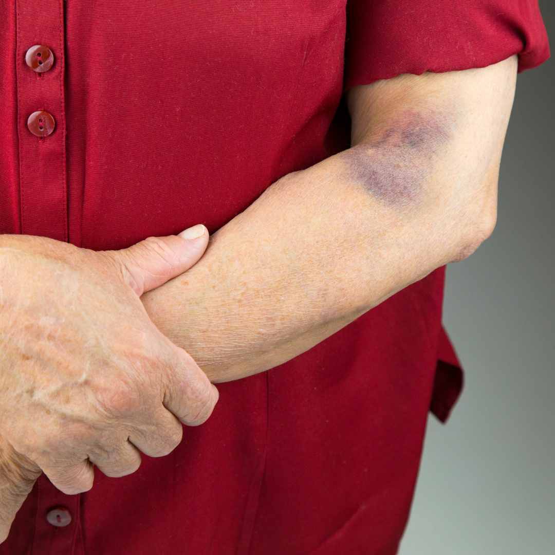 Alerta de queda na terceira idade