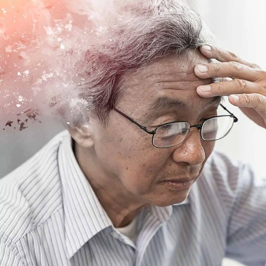 Alzheimer e seus sintomas